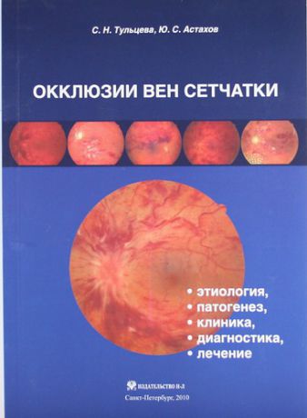 Тульцева С.Н. Окклюзии вен сетчатки (этиология, патогенез, клиника, диагностика, лечение)