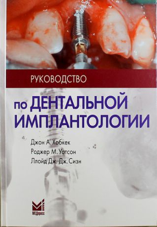 Хобкек Д.А. Руководство по дентальной имплантологии / 2-е изд.