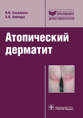 Альбанова, Вера Игоревна, Пампура, Александр Николаевич Атопический дерматит