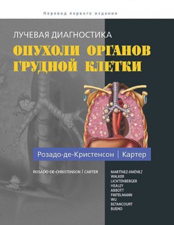 Розадо-де-Кристенсон М.Л.. Лучевая диагностика. Опухоли органов грудной клетки