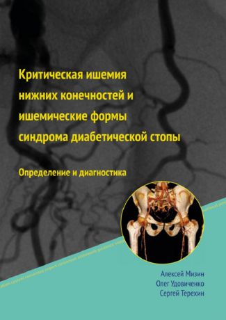 Алексей Мизин Критическая ишемия нижних конечностей и ишемические формы синдрома диабетической стопы