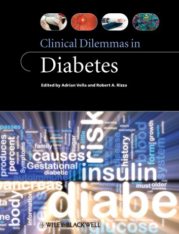Vella Adrian Clinical Dilemmas in Diabetes