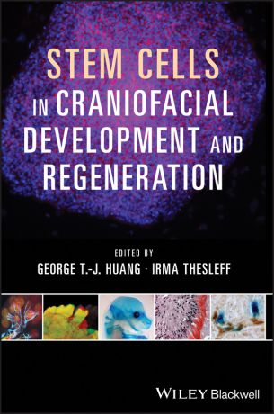 Thesleff Irma Stem Cells in Craniofacial Development and Regeneration