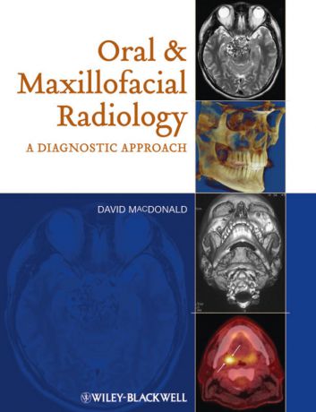 David Macdonald Oral and Maxillofacial Radiology. A Diagnostic Approach