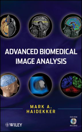 Mark Haidekker Advanced Biomedical Image Analysis