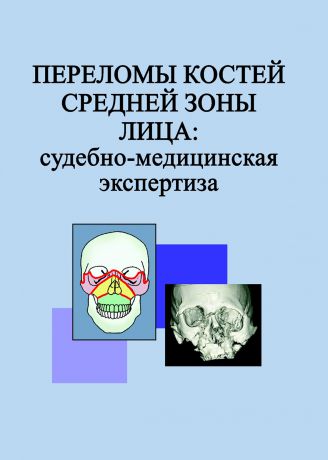 Л. Н. Гришенкова Переломы костей средней зоны лица: судебно-медицинская экспертиза