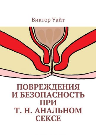 Виктор Уайт Повреждения и безопасность при т. н. анальном сексе