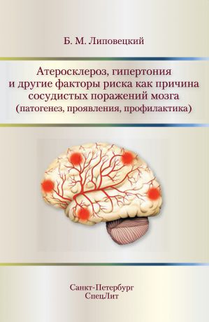 Б. М. Липовецкий Атеросклероз, гипертония и другие факторы риска как причина сосудистых поражений мозга (патогенез, проявления, профилактика)