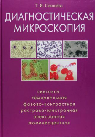 Свищёва, Тамара Яковлевна Диагностическая микроскопия: световая, тёмнопольная, фазово-контрольная, растрово-электронная, люминесцентная.