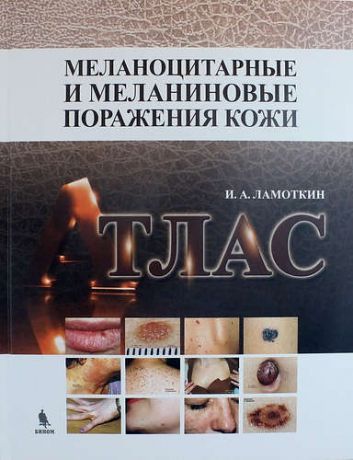 Ламоткин И.А. Меланоцитарные и меланиновые поражения кожи: учебное пособие