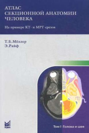 Мёллер, Торстен Б., Райф, Эмиль Атлас секционной анатомии. Т.1. Голова и шея