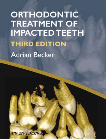 Adrian Becker Orthodontic Treatment of Impacted Teeth