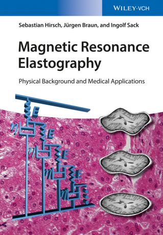 Jurgen Braun Magnetic Resonance Elastography. Physical Background and Medical Applications