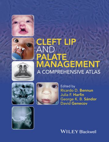 David Genecov Cleft Lip and Palate Management. A Comprehensive Atlas