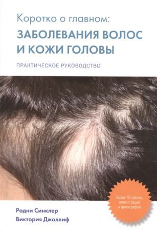 Синклер Р., Джоллиф В. Коротко о главном заболевания волос и кожи головы