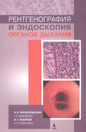 Чернеховская Н., Федченко Г., Андреев В., Поваляев А. Рентгенография и эндоскопия органов дыхания