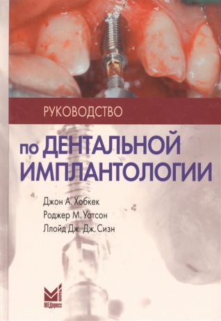 Хобкек Дж., Уотсон Р., Сизн Л. Руководство по дентальной имплантологии