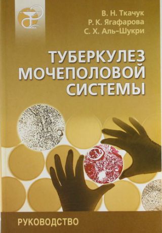 Ткачук В.Н. Туберкулез мочеполовой системы: Руководство для врачей