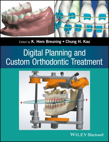 Chung Kau H. Digital Planning and Custom Orthodontic Treatment