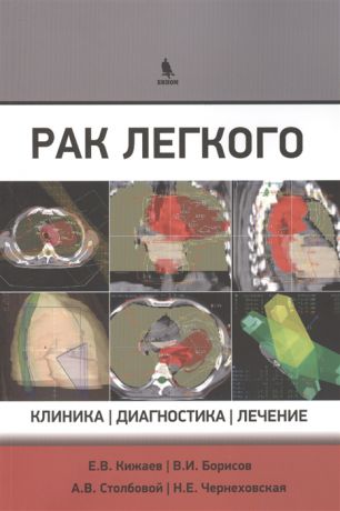 Кижаев Е., Борисов В., Столбовой А., Чернеховская Н. Рак легкого клиника диагностика лечение