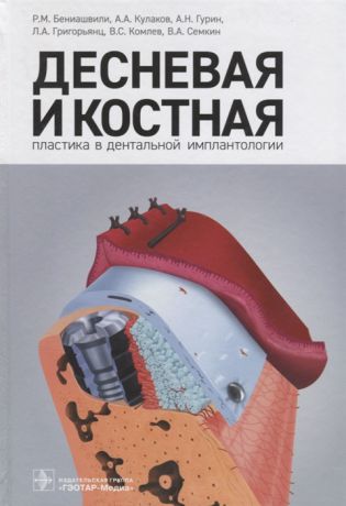 Бениашвили Р., Кулаков А., Гурин А. и др. Десневая и костная пластика в дентальной имплантологии