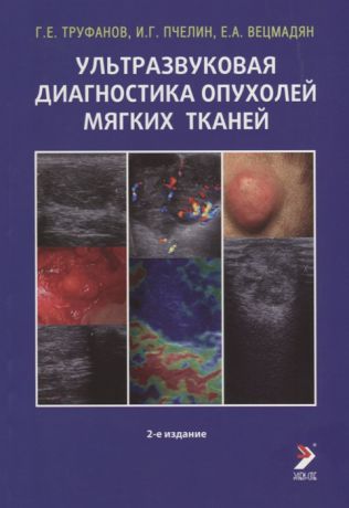 Труфанов Г., Пчелин И., Вецмадян Е. Ультразвуковая диагностика опухолей мягких тканей