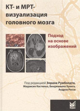Румболдт З., Кастильо М., Хуанг Б., Росси А. КТ- и МРТ- визуализация головного мозга Подход на основе изображдений