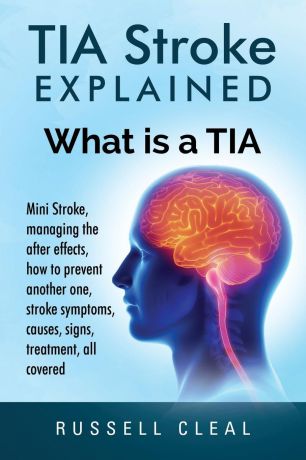 Russell Cleal Tia Stroke Explained. What is a Tia, Mini Stroke, managing the after effects, how to prevent another one, stroke symptoms, causes, signs, treatment, all covered