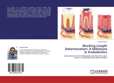 Saroosh Ehsan Working Length Determination: A Milestone in Endodontics