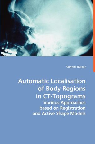 Corinna Bürger Automatic Localisation of Body Regions in CT Topograms