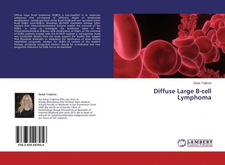 Sanja Trajkova Diffuse Large B-cell Lymphoma