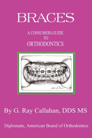 G. Ray BS DDS MS Callahan Braces. A Consumers Guide to Orthodontics
