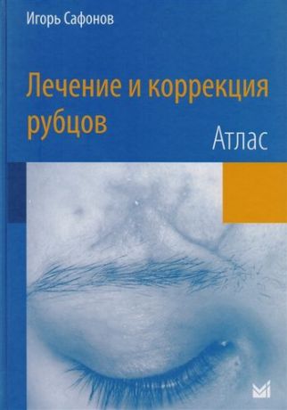 Сафонов И. Лечение и коррекция рубцов.Атлас