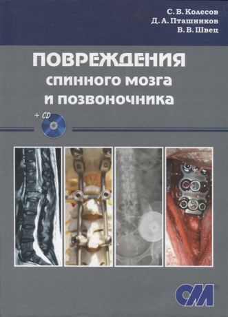 Колесов С., Пташников Д., Швец В. Повреждения спинного мозга и позвоночника CD