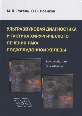 Рогаль М., Новиков С. Ультрозвуковая диагностика и тактика хирургического лечения рака поджелудочной железы Руководство для врачей