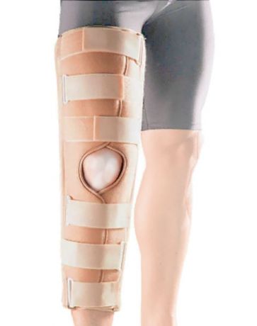Ортопедическое изделие Бандаж на коленный сустав Oppo Medical 51cm размер XL 4030-20XL
