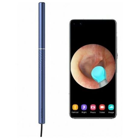 Умная ушная палка Xiaomi Bebird K10 Blue