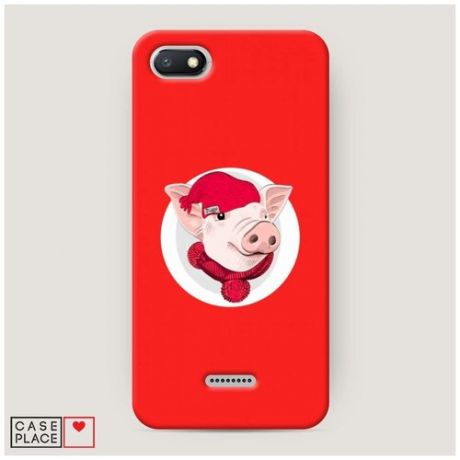 Чехол Пластиковый Xiaomi Redmi 6A Новогодняя свинка