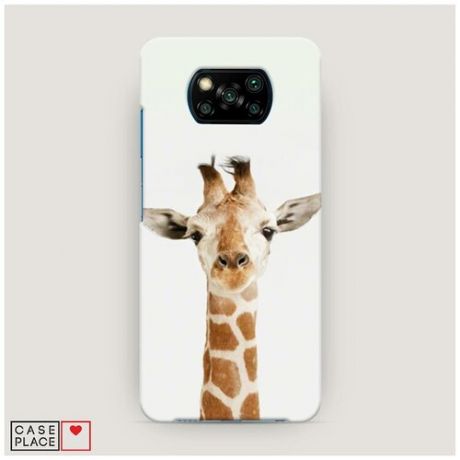 Чехол Пластиковый Xiaomi Poco X3 NFC Любопытный жираф
