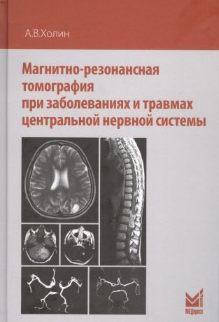 Холин Александр Васильевич Магнитно-резонансная томография при заболеваниях и травмах центральной нервной системы