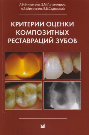 Митронин Александр Валентинович, Николаев Александр Иванович Критерии оценки композитных реставраций зубов